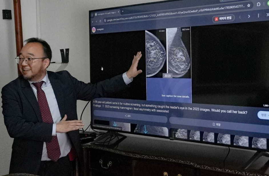 Novedosa tecnología facilita detección temprana del cáncer de mama cdf 04